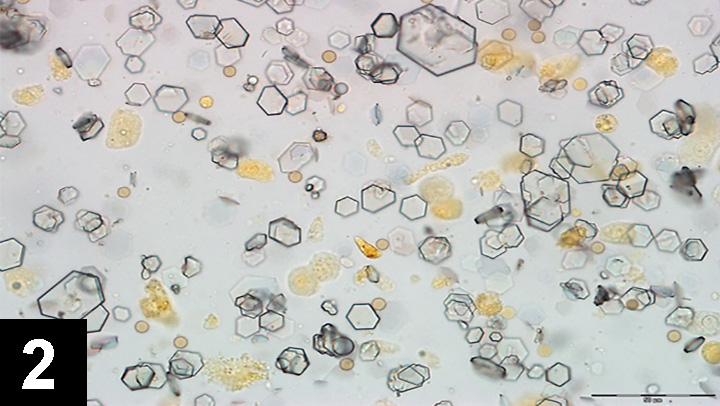 <p>What type of crystal is this?</p>