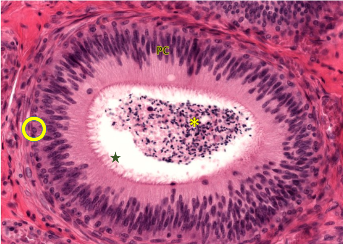 <p>Function: sperm transport and maturation</p><p>Histology things:</p><p>Principal cells: long, pseudostratified/simple columnar epithelium </p><p>basal cells</p><p>stereocilia(on principal cells)</p><p>Spermatozoa (in middle) </p>
