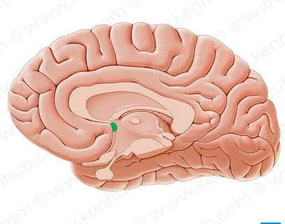 <p>Identify the structure pinned</p>