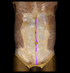 <p>Identify the structure</p>