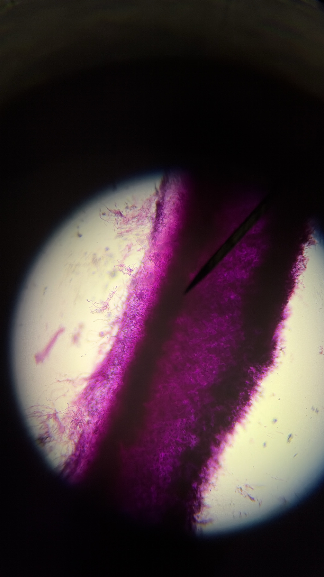 <ol><li><p>This slide shows a/an:</p></li></ol><p class="p1">a) Prokaryotic cell</p><p class="p1">b) Eukaryotic cell</p><p class="p1">c) None of the above</p><ol start="2"><li><p class="p1">Which type of cells does this slide show?</p><p class="p1">a) Cocci cells</p><p class="p1">b) Bacilli cells</p><p class="p1">c) Spirilli cells</p><p class="p1">d) None of the above</p></li></ol><ol start="3"><li><p class="p1">Which type of cell does this slide show an example of:</p></li></ol><p class="p1">a) Spirogyra</p><p class="p1">b) Volvox</p><p class="p1">c) Diatoms</p><p class="p1">d) None of the above</p><ol start="4"><li><p class="p1">Which type of cell does this slide show an example of:</p><p class="p1">a) Amoeba</p><p class="p1">b) Paramecium</p><p class="p1">c) None of the above</p></li><li><p class="p1">Which type of cell does this slide show an example of:</p><p class="p1">a) Archaebacteria or Eubacteria</p><p class="p1">b) Plantae</p><p class="p1">c) Protista</p><p class="p1">d) Fungi</p><p class="p1">e) Animalia</p></li></ol><p class="p1"></p><p class="p1"></p>