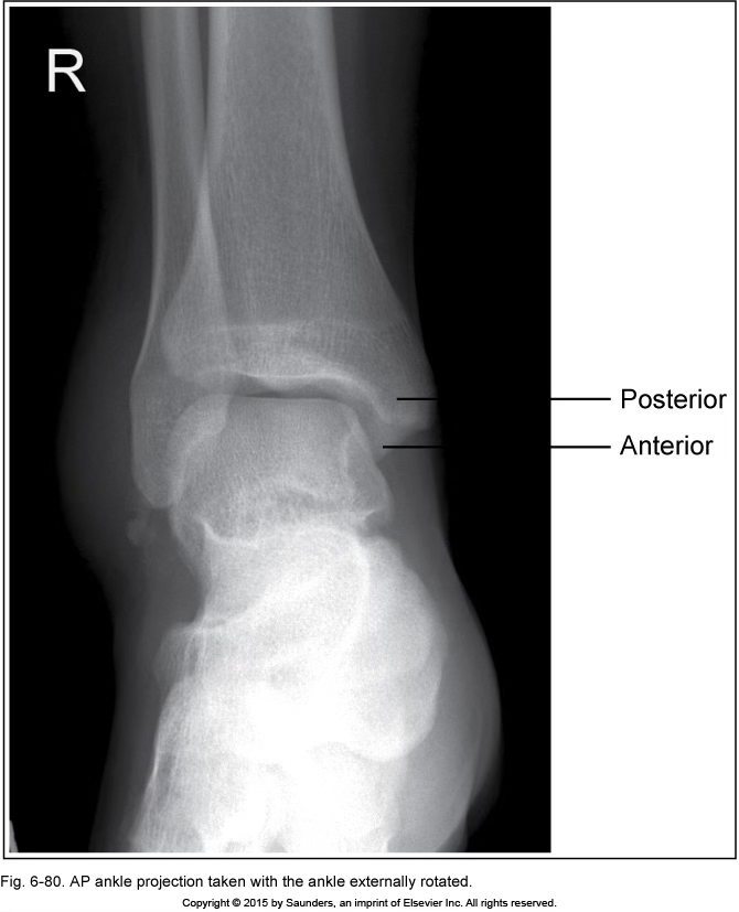 <p>AP ankle</p>