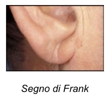 <p><span>• </span><strong><span>Padiglione:</span></strong><span> Si ricercano tofi gottosi (cristalli di acido urico), segno di Frank (solco sul lobo), cianosi. Una malattia rara ed espressione paraneoplastica è la policondrite ricorrente, che causa grave infiammazione del padiglione risparmiando però il lobo.</span></p><p><span>• </span><strong><span>Meato uditivo:</span></strong><span> Emorragie (fratture craniche), secrezioni, eczema, foruncolosi.</span></p>