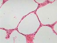 <p>Description: single layer or flattened cells with disc-shaped central nuclei and sparse cytoplasm.Simple of the epithelia.</p><p>Functions: allows materials to pass by diffusion and filtration in sites where protection is not imp.</p><p>Location: kidney, air sacs lungs, lining of heart</p>