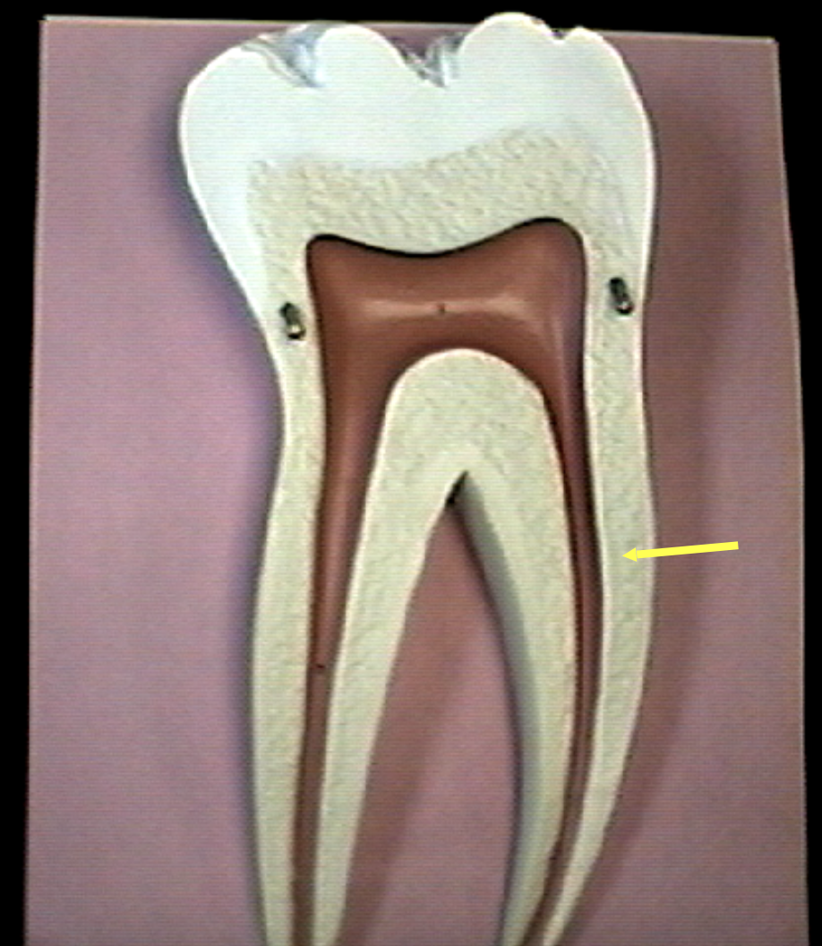 <p>Identify the organs of the digestive tract.</p>