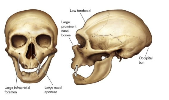 <p>Neanderthal cold adaptations</p>