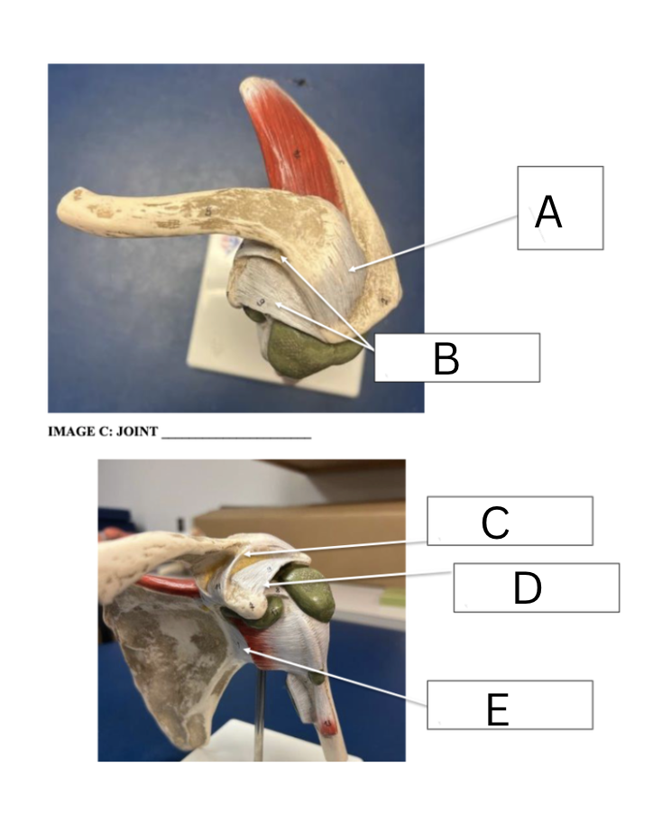 <p><span>Label the ligaments of the shoulder</span></p>
