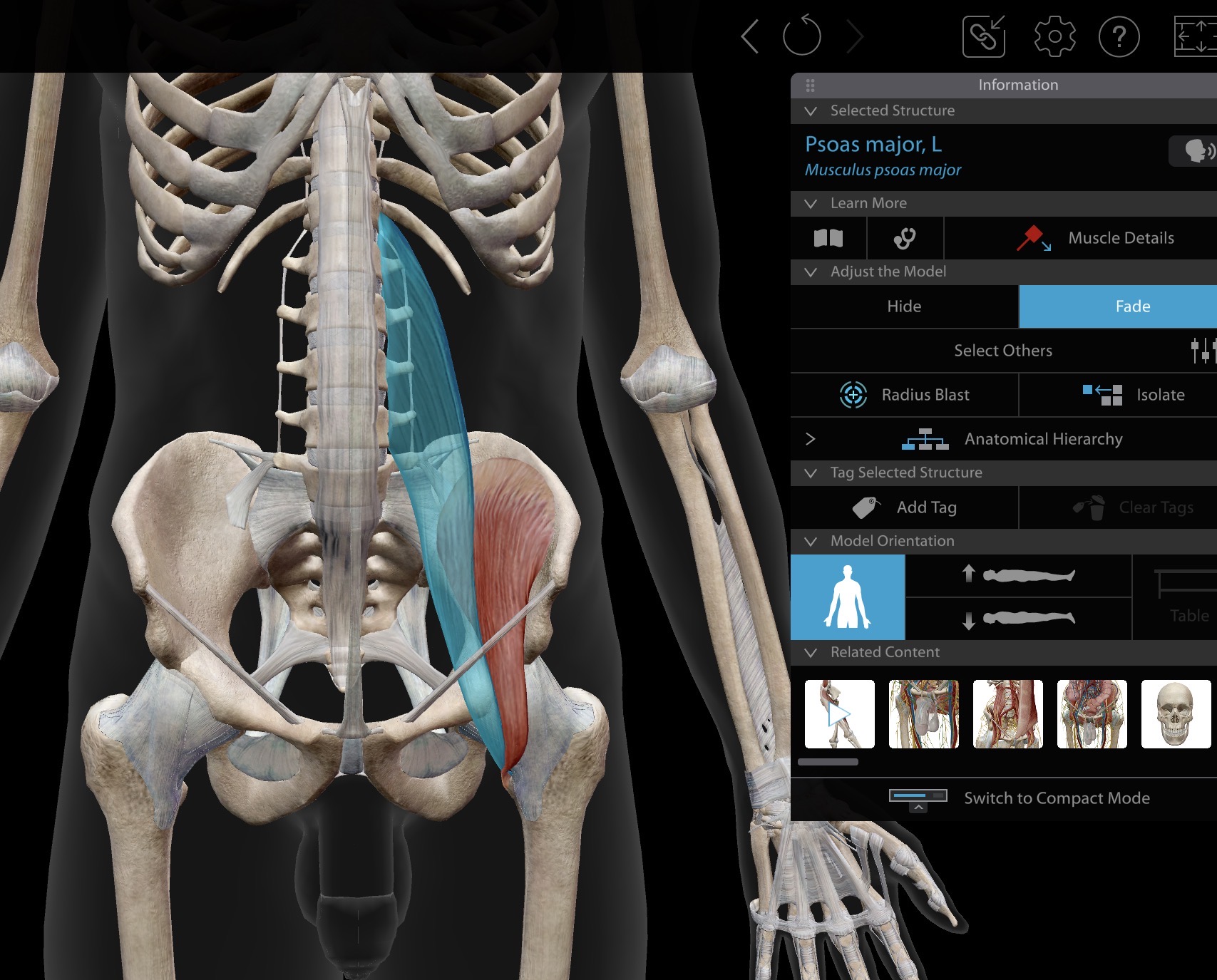 <p>iliopsoas (muscle of anterior compartment)</p>