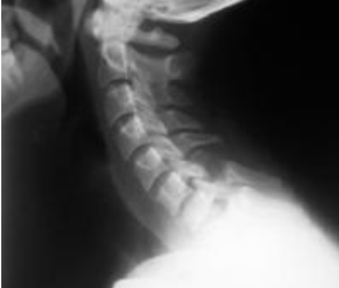 <p>What is the diagnosis?</p>