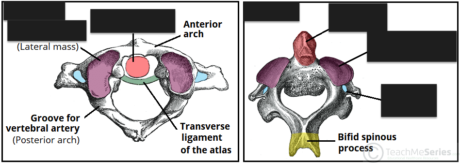 <p>name the left structure and tagged areas (left to right).</p>