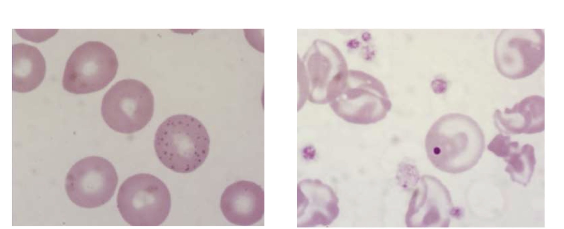 <p>Name these 2 inclusion types</p>