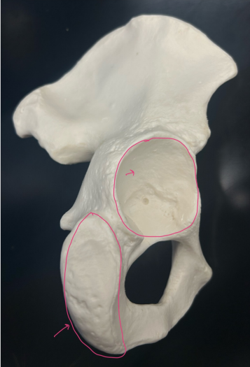 <p>What bone is this?</p>