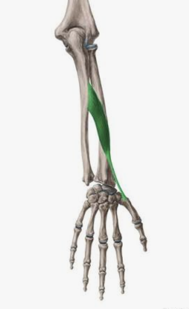 <p>Which muscle is this?</p>