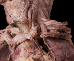 <p>name this structure</p>