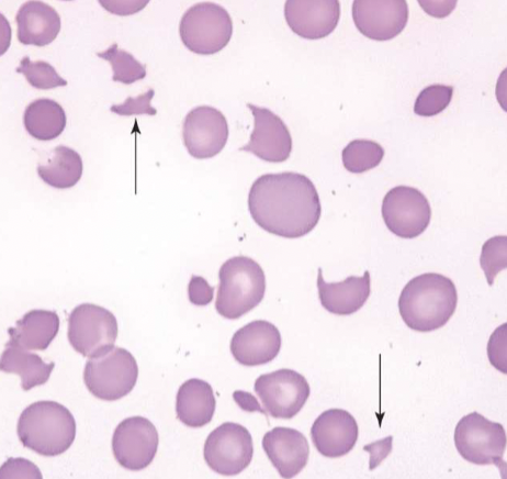 <p>name the type of RBC</p>
