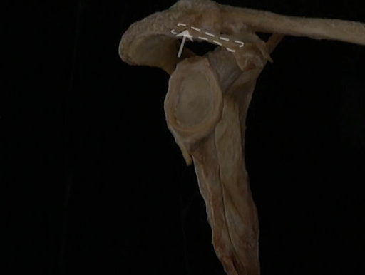 <p>Oppervlakkig, schouder</p>