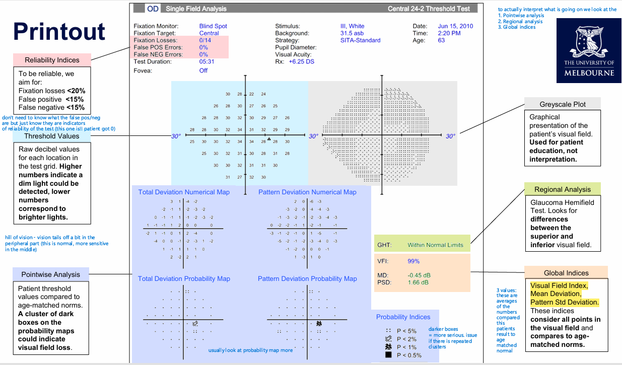 <ol><li><p>Pointwise analysis </p></li></ol><ul><li><p>Patient threshold values compared to age-matched norms. </p></li><li><p>A cluster of dark boxes on the probability maps could indicate visual field loss</p></li></ul><ol start="2"><li><p>Regional analysis </p></li></ol><ul><li><p>Glaucoma Hemifield Test. Looks for differences between the superior and inferior visual field</p></li></ul><ol start="2"><li><p>Global indices </p></li></ol><ul><li><p><em>three</em> values: </p><ul><li><p>1. Visual Field index </p></li><li><p>Mean Deviation </p></li><li><p>Pattern Std Deviation </p></li><li><p>these indices consider all points in the visual field and compares to age-matched norms </p></li></ul></li><li><p></p></li><li><p><em>general info. Higher numbers indicate dim light could be detected, lower corresponds to brighter lights </em></p></li><li><p>there are reliability indices that are indicators of reliability </p></li><li><p><em>greyscale plot just for info </em></p></li></ul><p></p>