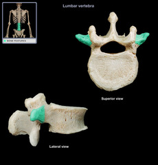 <p>two lateral projections from the vertebral arch</p>