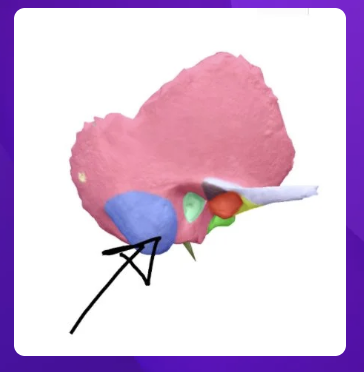 <p>which bony landmark is the arrow pointing to?</p>