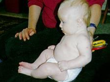 <p>when does this reflex occur? - sits only with support</p>