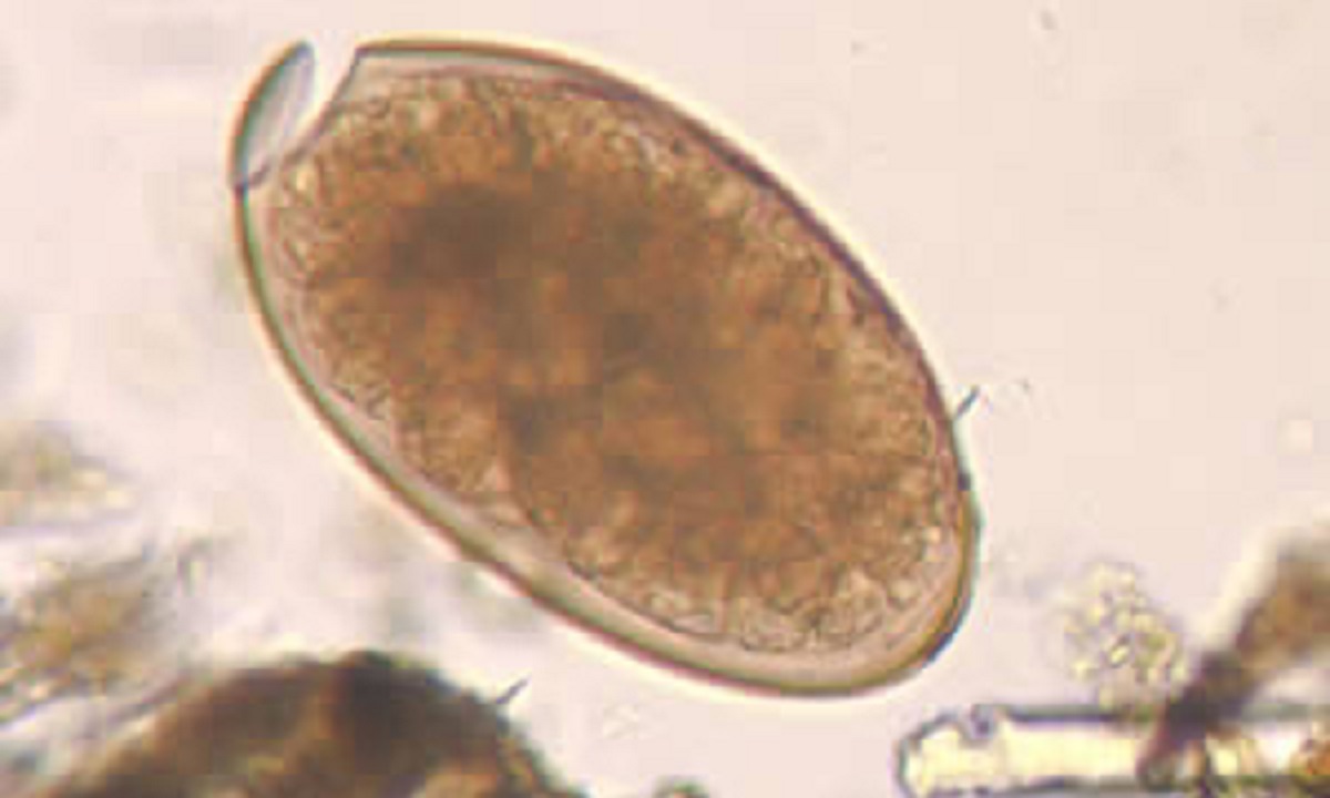 <p>fasciola hepatica</p>