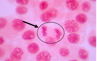 <p><span><br>Chromatids are being drawn to opposing<br>poles of the cell<br>• Two separate sets of chromosomes<br>• “Tails” point toward middle</span></p>
