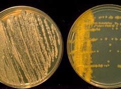 <p>Develop pigment when exposed to light (PHOTOCHROMIC)</p>
