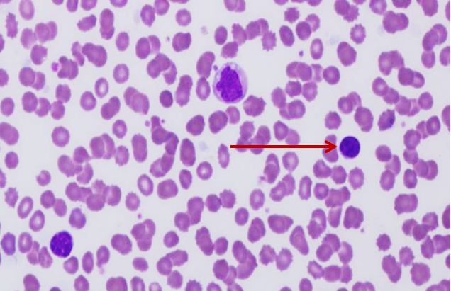 <p>Tế bào gì ?</p>