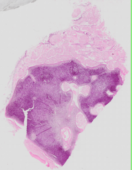term image