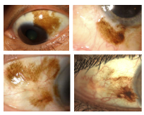 <p>What is the most likely diagnosis ?</p>
