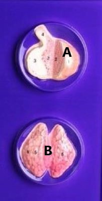 <p>B</p>