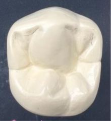 <p>Which premolars do not have a crown that tapers toward the lingual?</p>