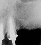 <p>describe the appearance of the lesion:</p>