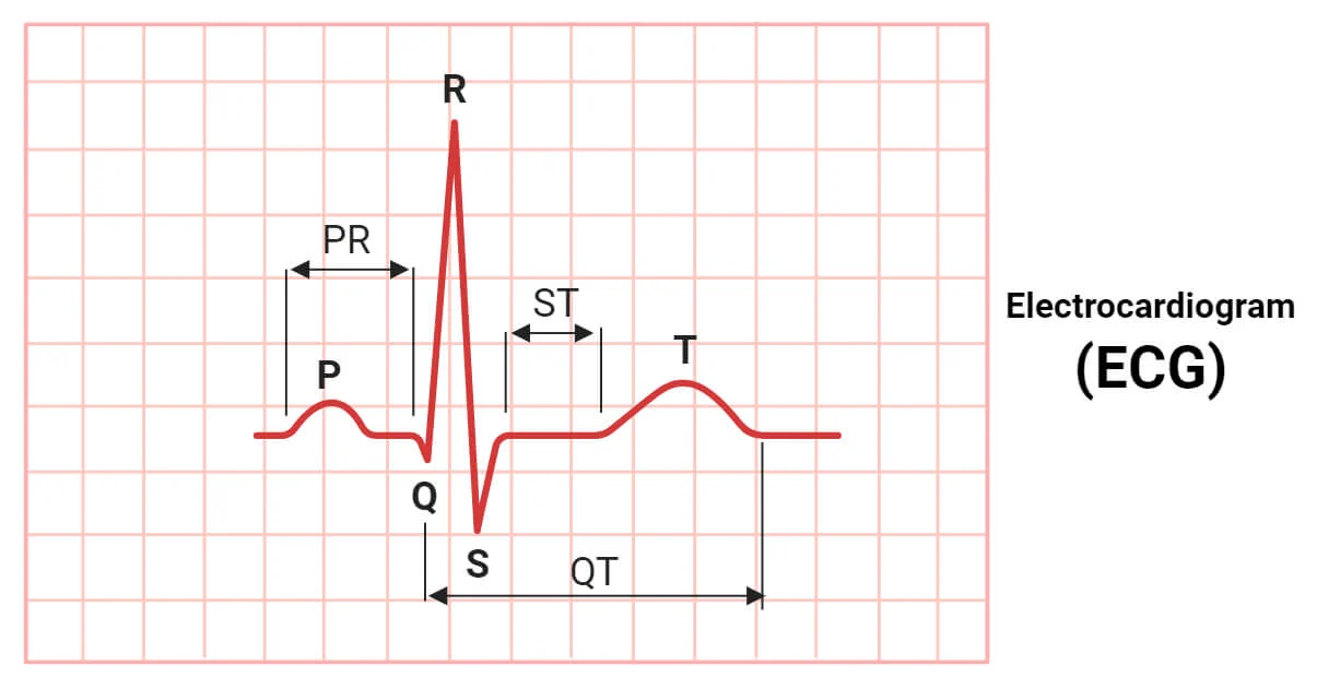 <p>Identify P, QRS and T</p>