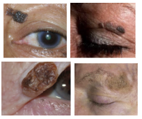 <p>What is the most likely diagnosis?</p>