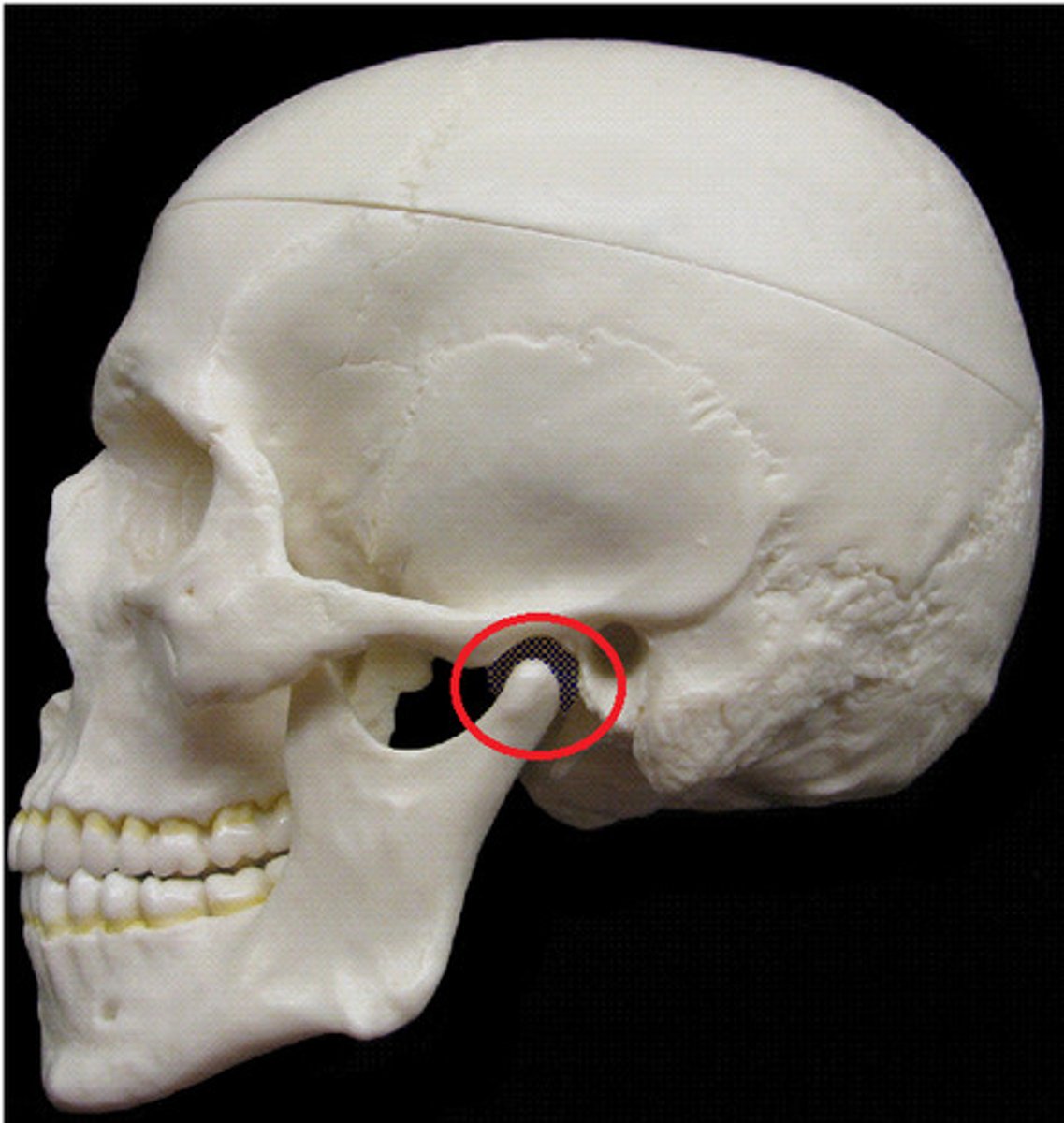 <p>Mandible</p>