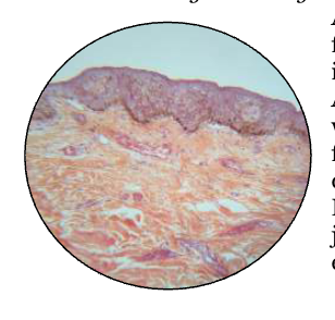 <p>? CT Proper</p>