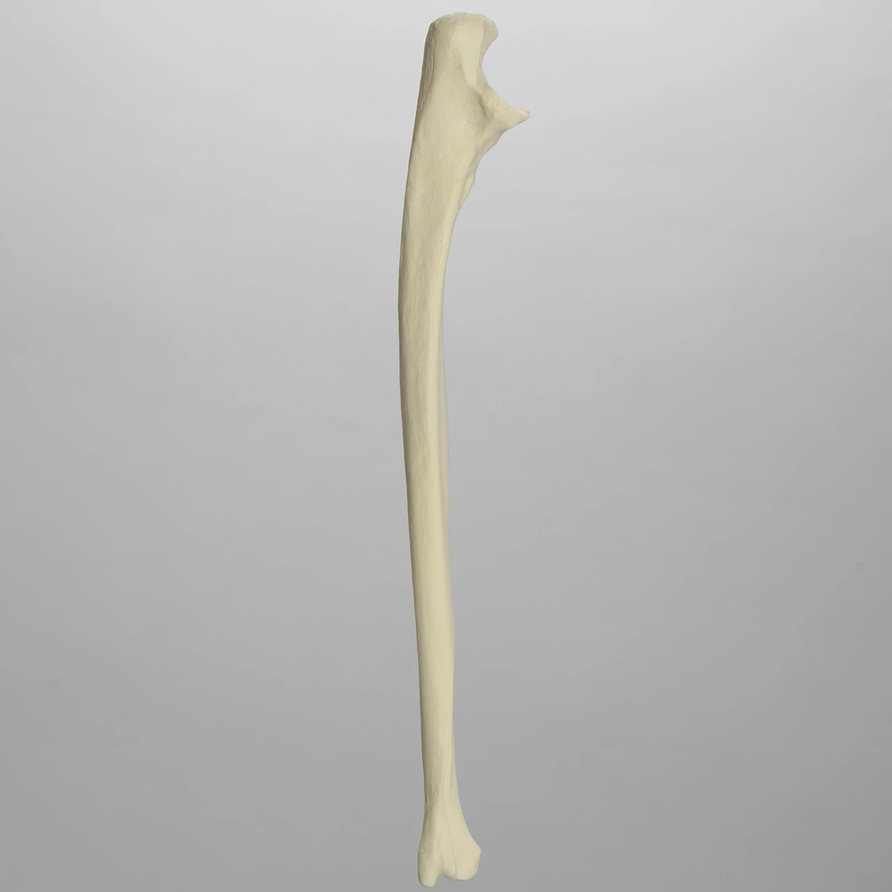 <p>Left or right bone</p>