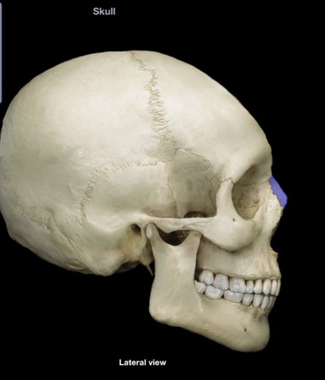 term image