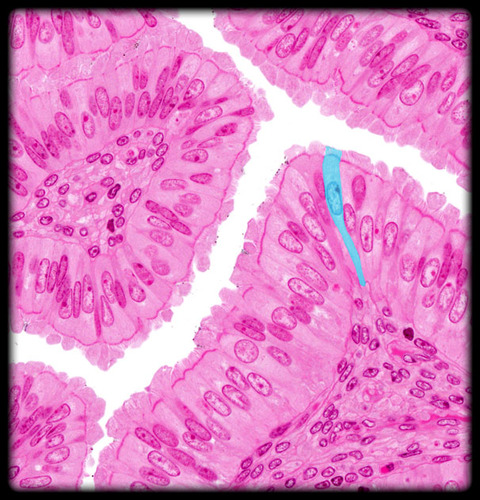 <p>-Function: Moves mucus and trapped particles using cilia; helps protect and clear passageways</p><p>-Found: Respiratory tract, fallopian tubes</p><p>-Description: One layer of tall cells with cilia on the surface</p>