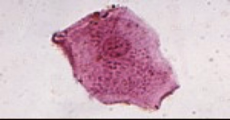 <ul><li><p><strong>Largest cells observed </strong>in urine sediments.</p></li><li><p>Flat, thin cells with a homogeneous appearance and often have straight edges with distinct corners that sometimes curl or fold.</p></li></ul><p></p>