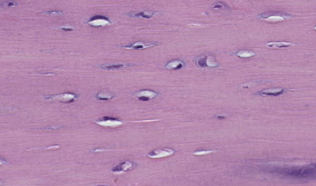 <p>what sructures are located within the lacunae?</p>