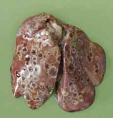 <p>What is the distribution of this lesion?</p><p>A Focal</p><p>B Locally extensive</p><p>C Multifocal to coalescing</p><p>D Diffuse</p>