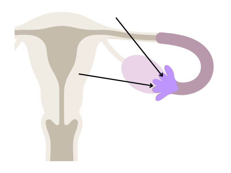 <p><span>Identify the highlighted part of the female reproductive system below, the darker purple where the arrows are pointing. </span></p>
