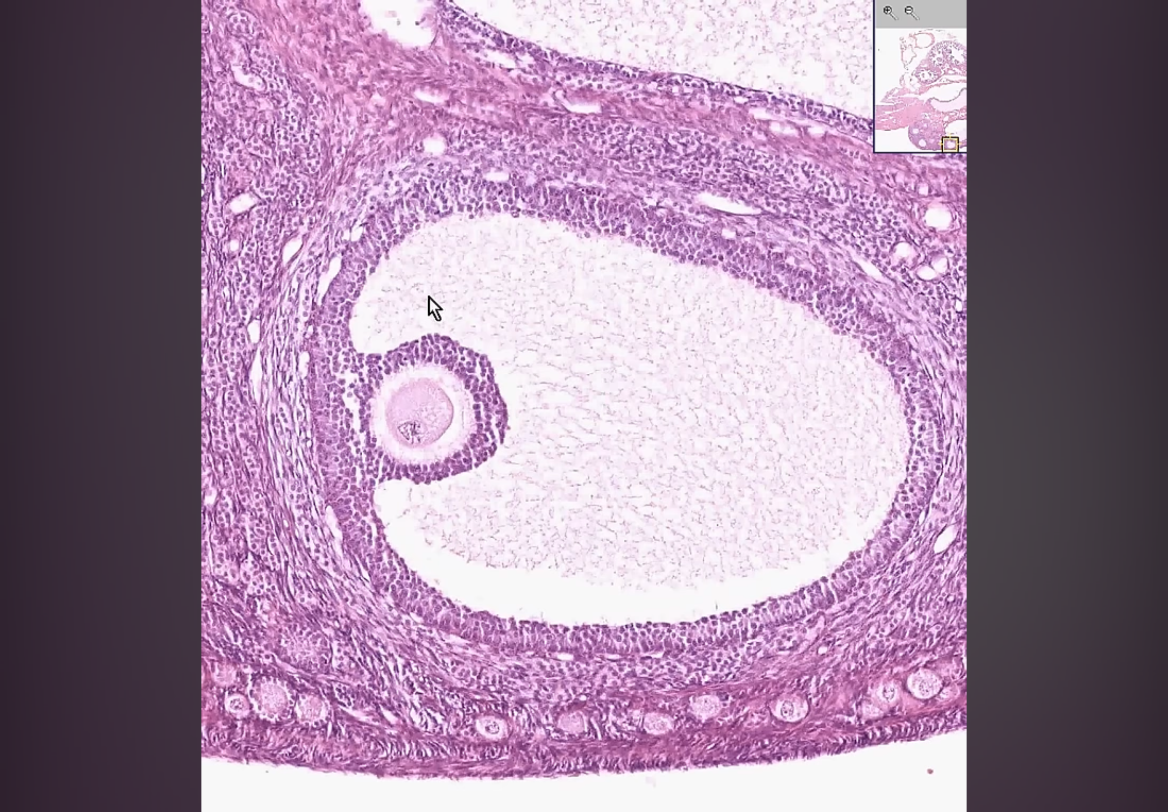 <p>what kind of follicle</p>