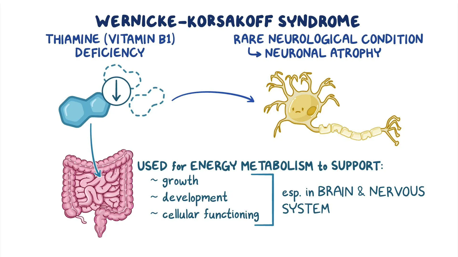 <p>Which of these individuals is most likely to present with Wernicke-Korsakoff syndrome?</p><p>A. An infant born prematurely</p><p>B. An adult with alcoholism</p><p>C. An adult who is postmenopausal</p><p>D. A child with a neurological disorder</p>