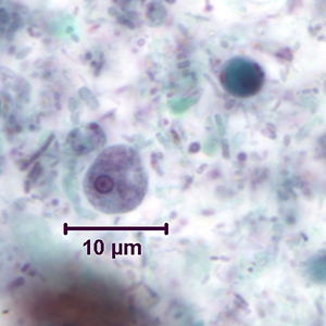 <p>5-15 um, small/compact karyosome</p>
