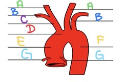 <p>Identify the left and right common carotid arteries. </p>