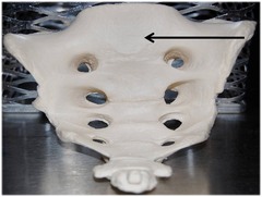 <p>Name this entire bone.</p>