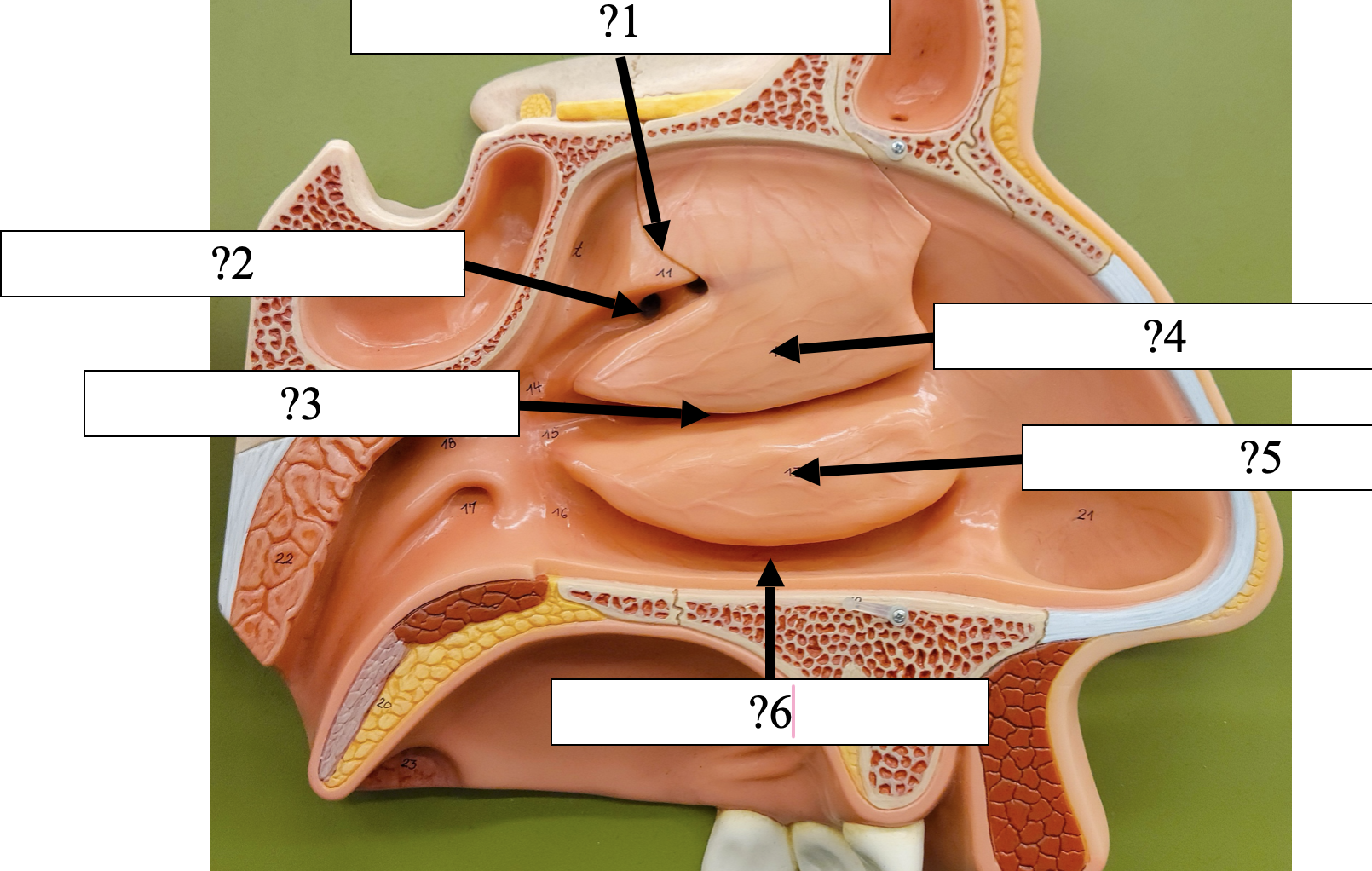 <p>1 Name the bone?</p>